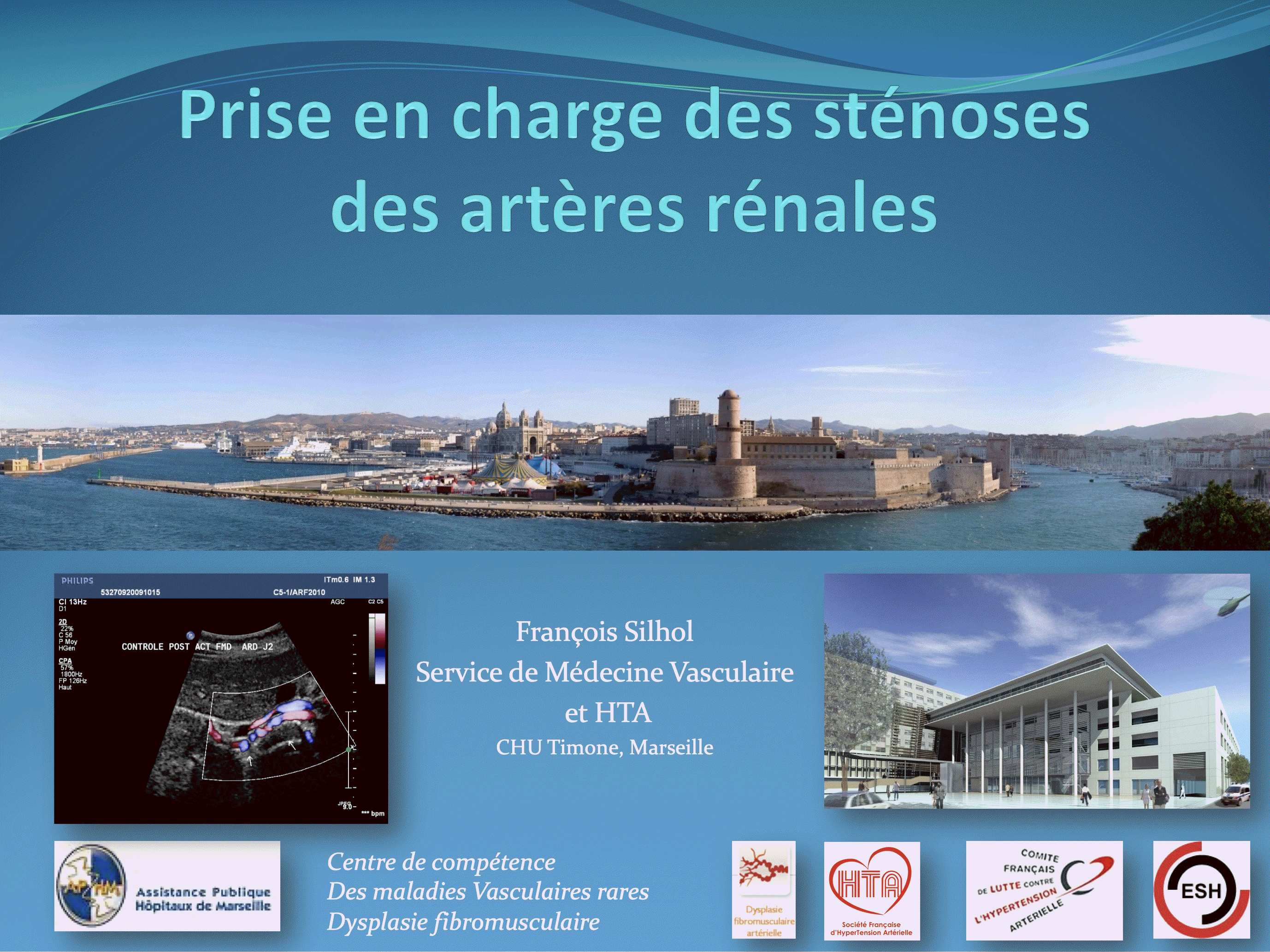 Artéres Rénales - Médecine Vasculaire - Marseille