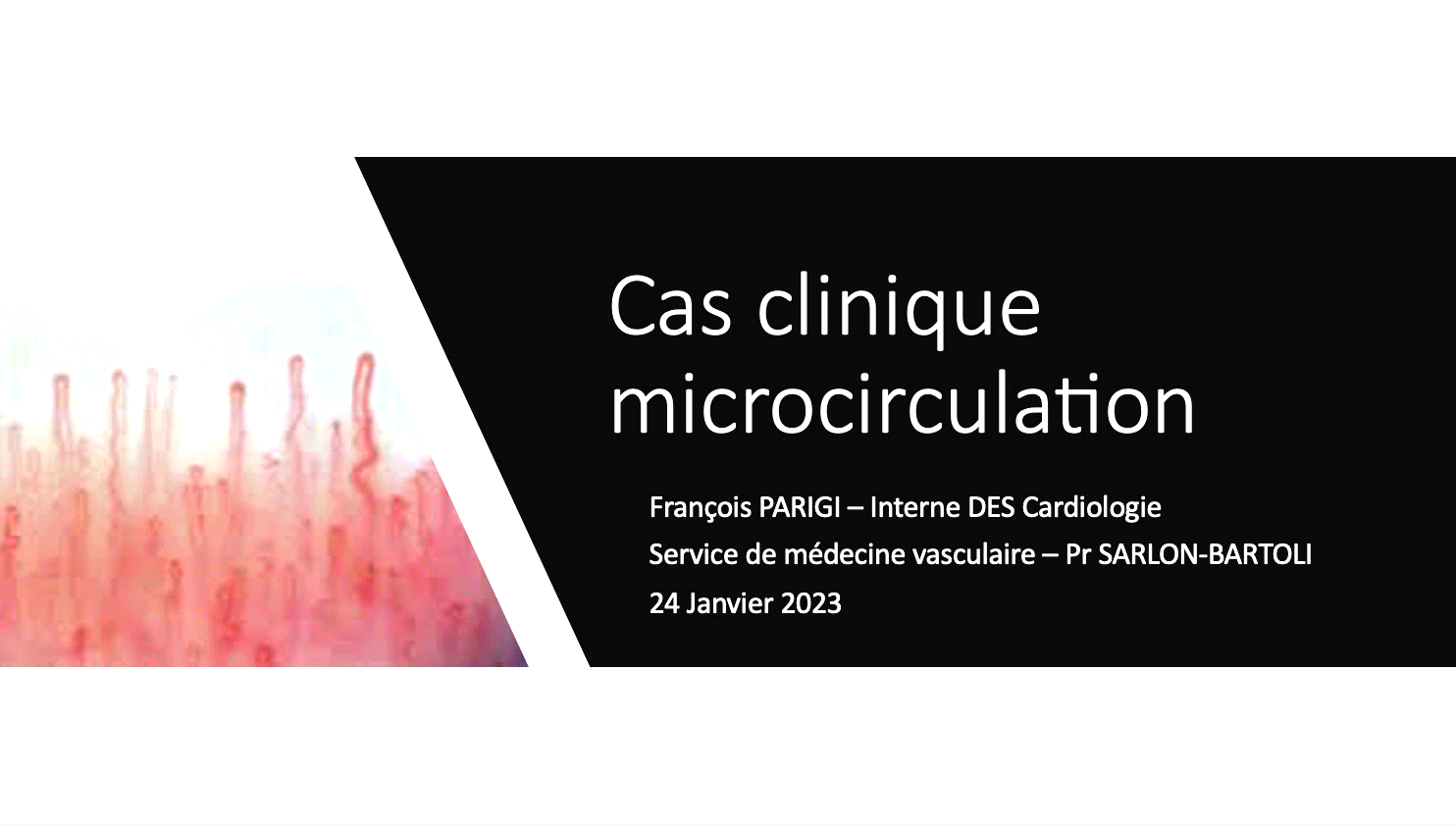 Microcirculation - Médecine Vasculaire - Marseille