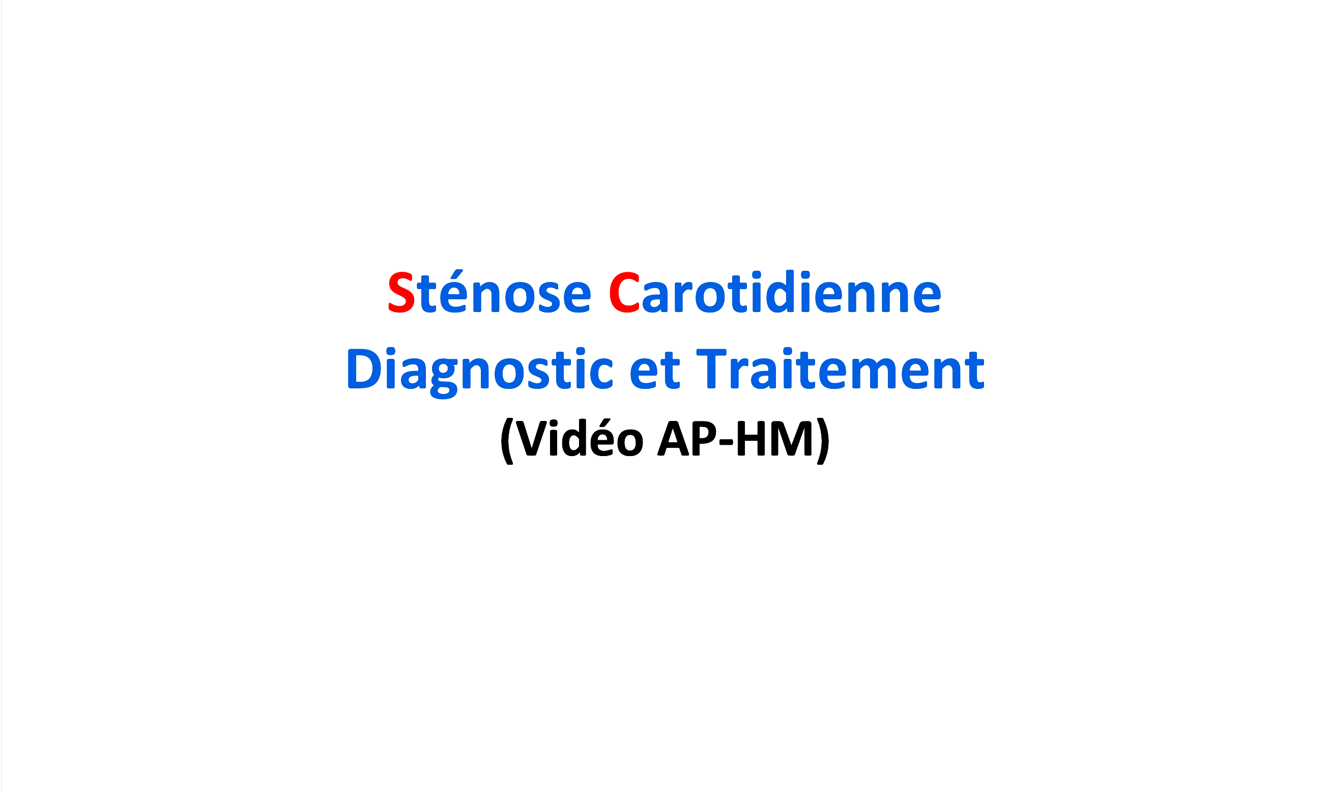 Dr RENUCCI - Sténose Carotidienne